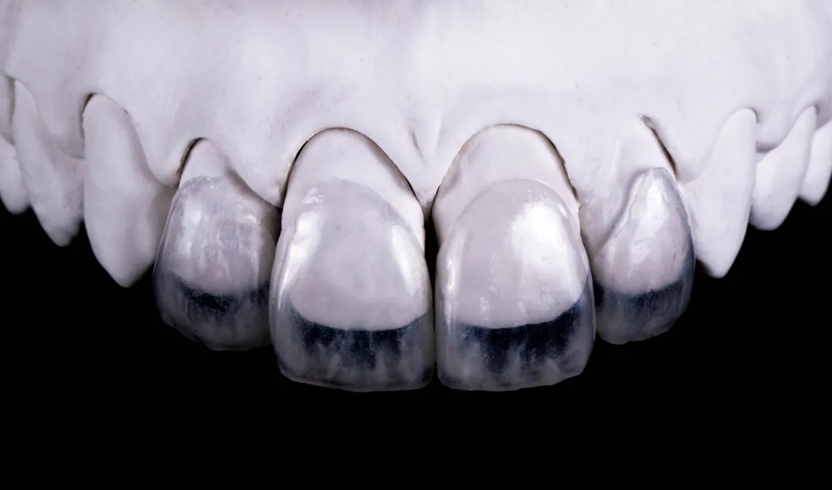 Cosmetic Dentist in Argüelles, Madrid